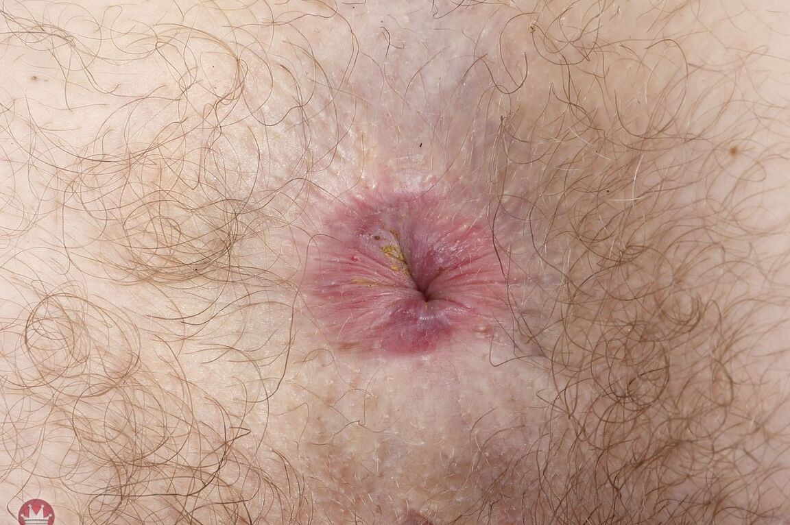 21P Mature Jane Vervain giving arousing close-up views of her spread hairy pussy