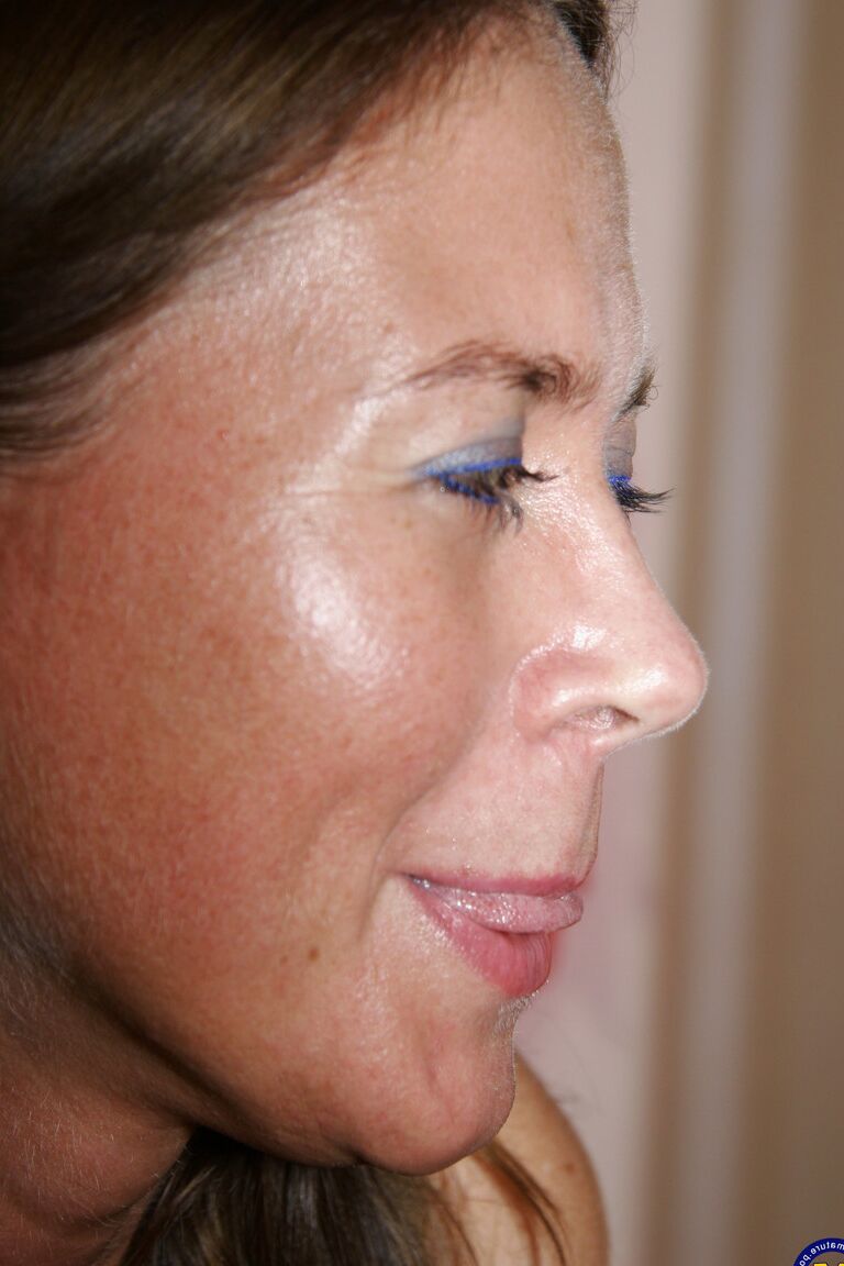 21P Jolanta, la esposa de ojos azules, muestra su cuerpo y es embestida antes de un tratamiento facial