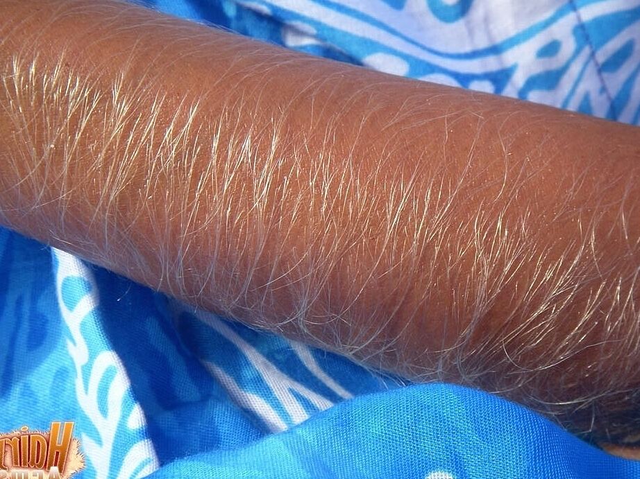 21P Hairy Arms Lori Anderson