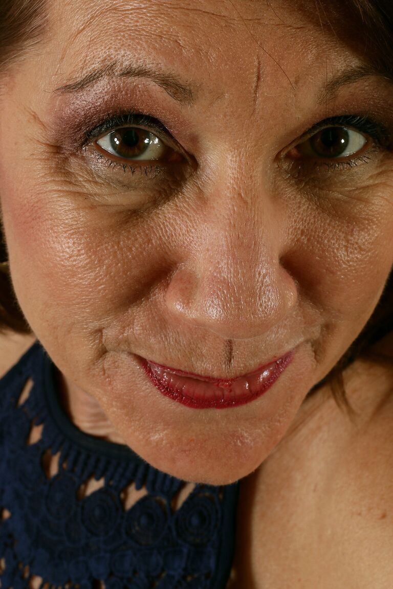 21P Wrinkled granny Lynn showing her saggy tits & delicious pussy in stockings