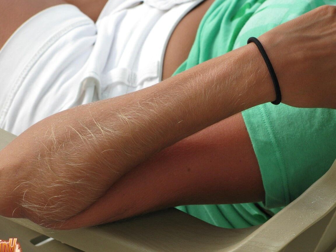 14P Amateur model Lori Anderson shows her her really hair arms while at the beach