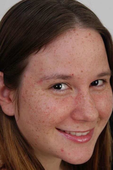 20P Chubby girl with freckles reveals unshaven pits and pussy on weight bench