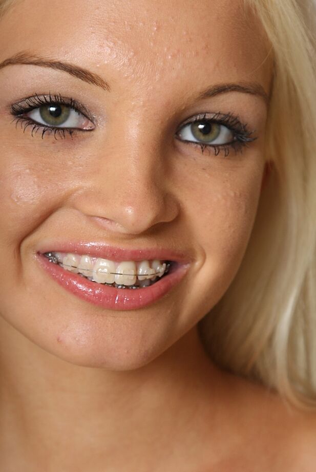 16P Barley legal hottie Franziska modelling solo in braces and panties
