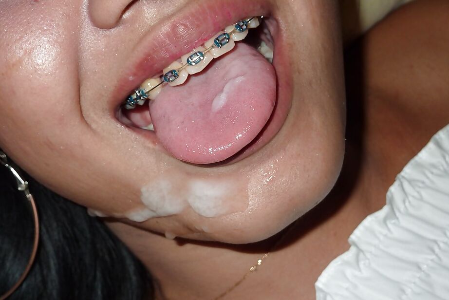 16P Thai hooker with hairy pussy taking cumshot on braces after hardcore fuck