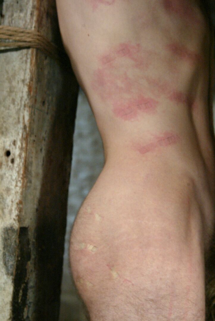 21P Men In Pain Annie Cruz, Elliot Skellington