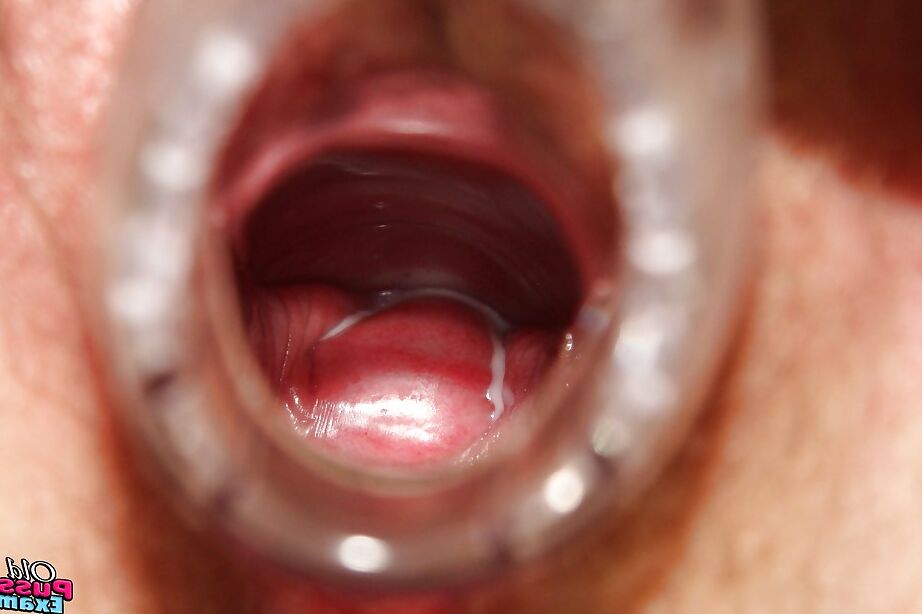 16P Chubby redhead granny masturbating her unshaven cunt in gyno office