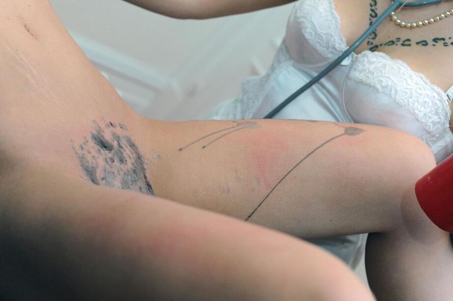 16P Blond chick in a nurse's cap and lingerie tortures a woman with wax and clamps