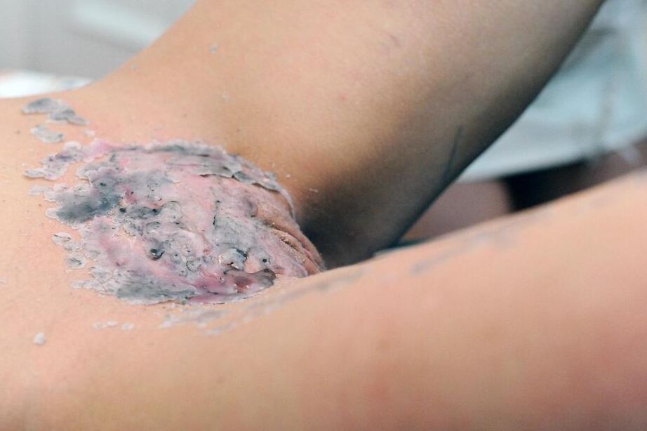 16P Blond chick in a nurse's cap and lingerie tortures a woman with wax and clamps