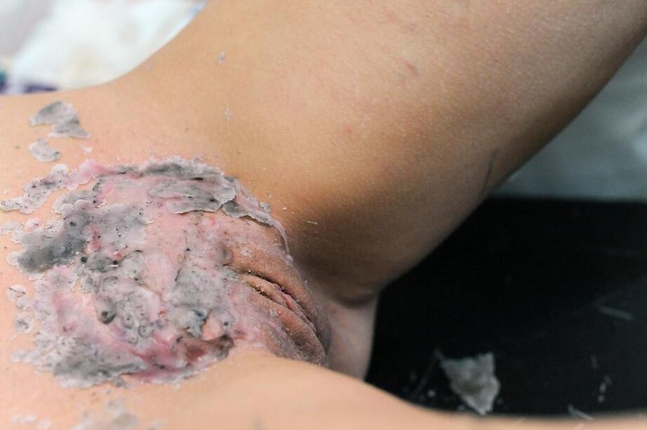 16P Blond chick in a nurse's cap and lingerie tortures a woman with wax and clamps