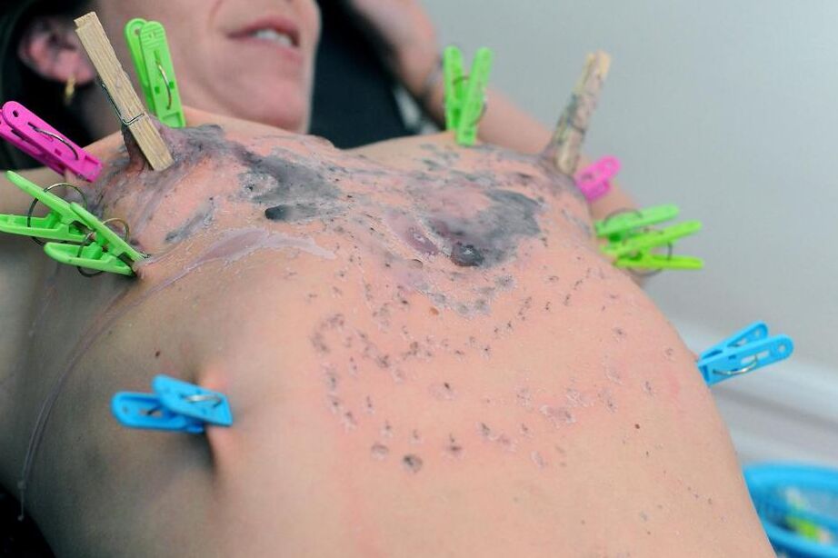 16P Blond chick in a nurse's cap and lingerie tortures a woman with wax and clamps