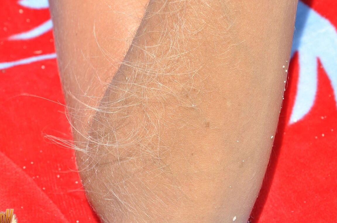 21P American babe in sunglasses Lori Anderson flaunts her tiny tits and hairy arms