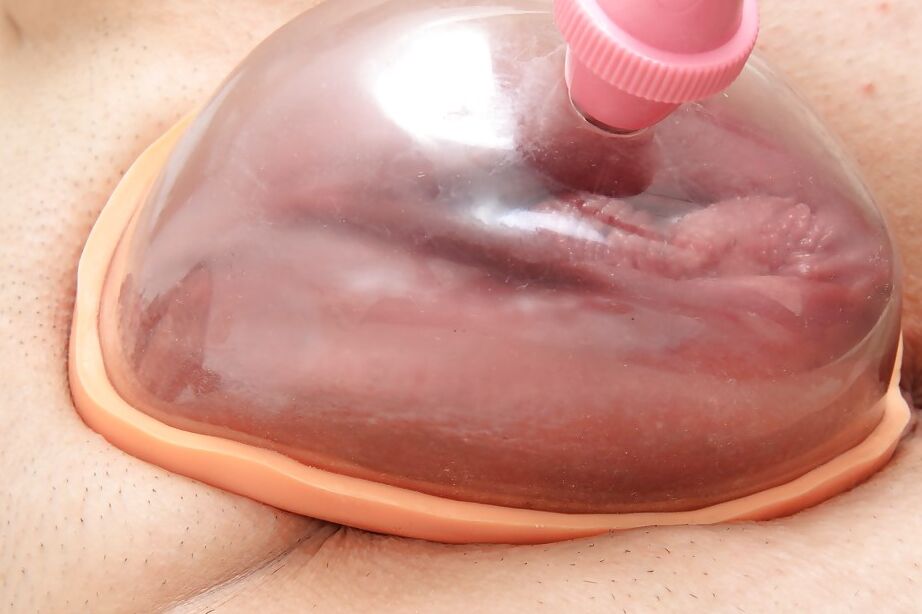 16P Carmelita shows off her mature pussy while taking part in a gyno scene