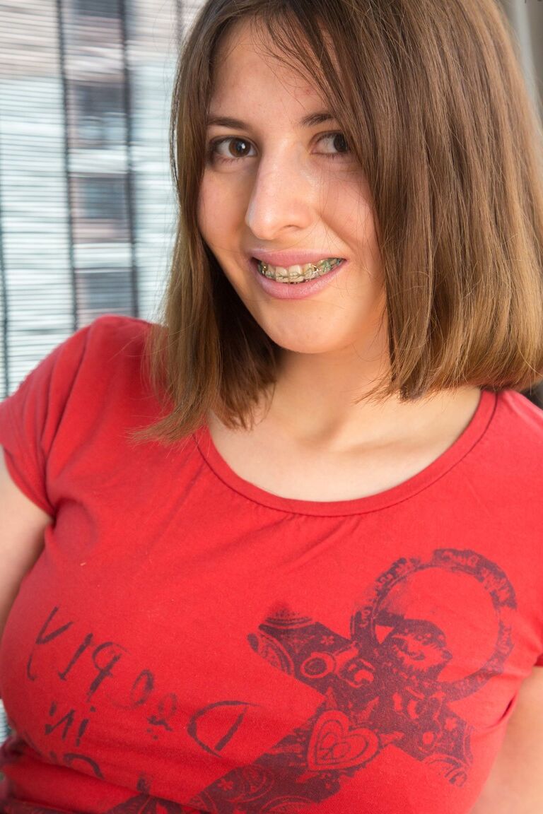 20P Andreea, une adolescente potelée avec un appareil dentaire, enlève son short pour exposer son buisson naturel.