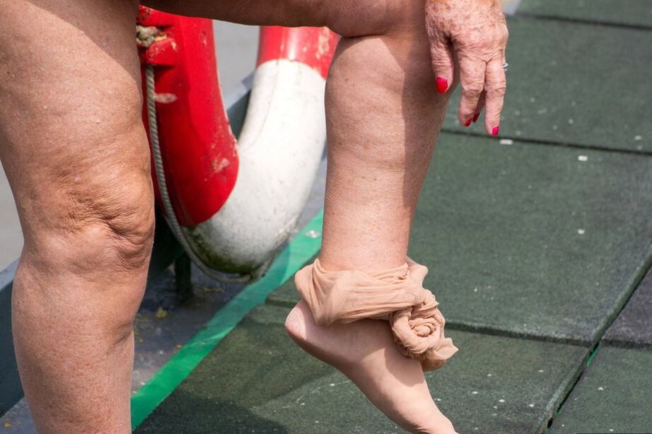 20P Obese oma Grandma Libby doffs a see-through raincoat to get naked on a bridge