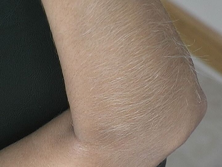 21P Sweet American MILF Lori Anderson exercises and flaunts her hairy body