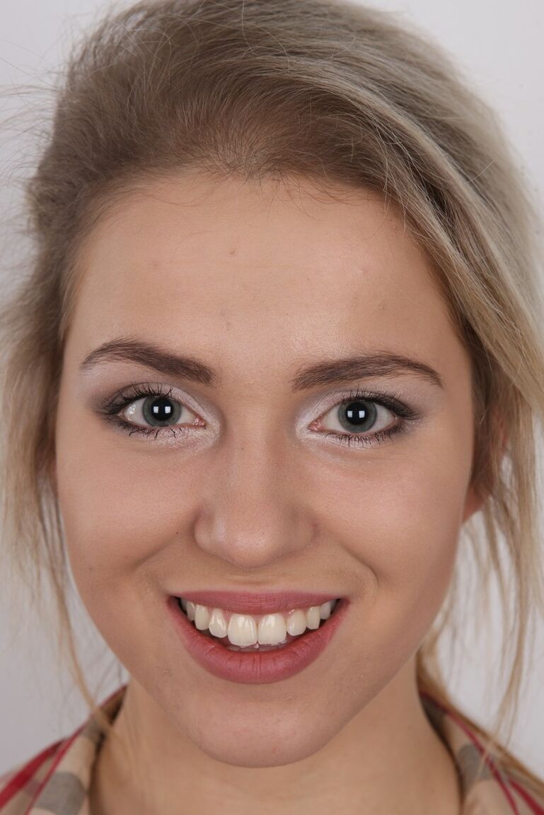 20P Pretty Alzbeta shows her smiley face and hard nipples to the camera