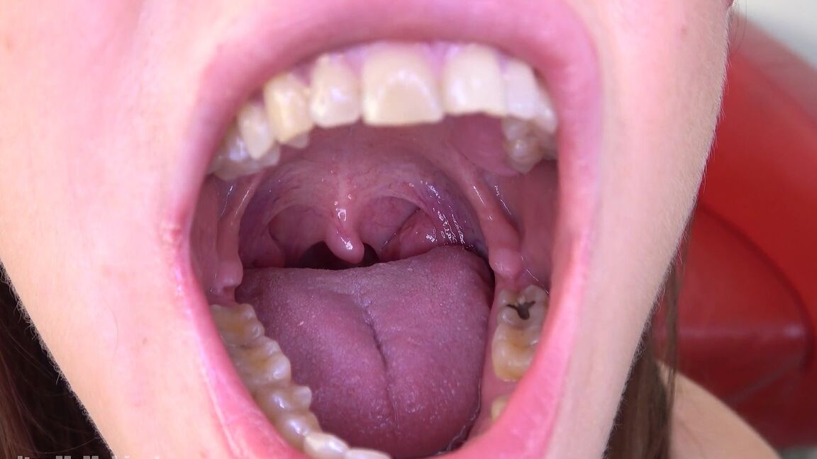 15P Inside My Mouth
