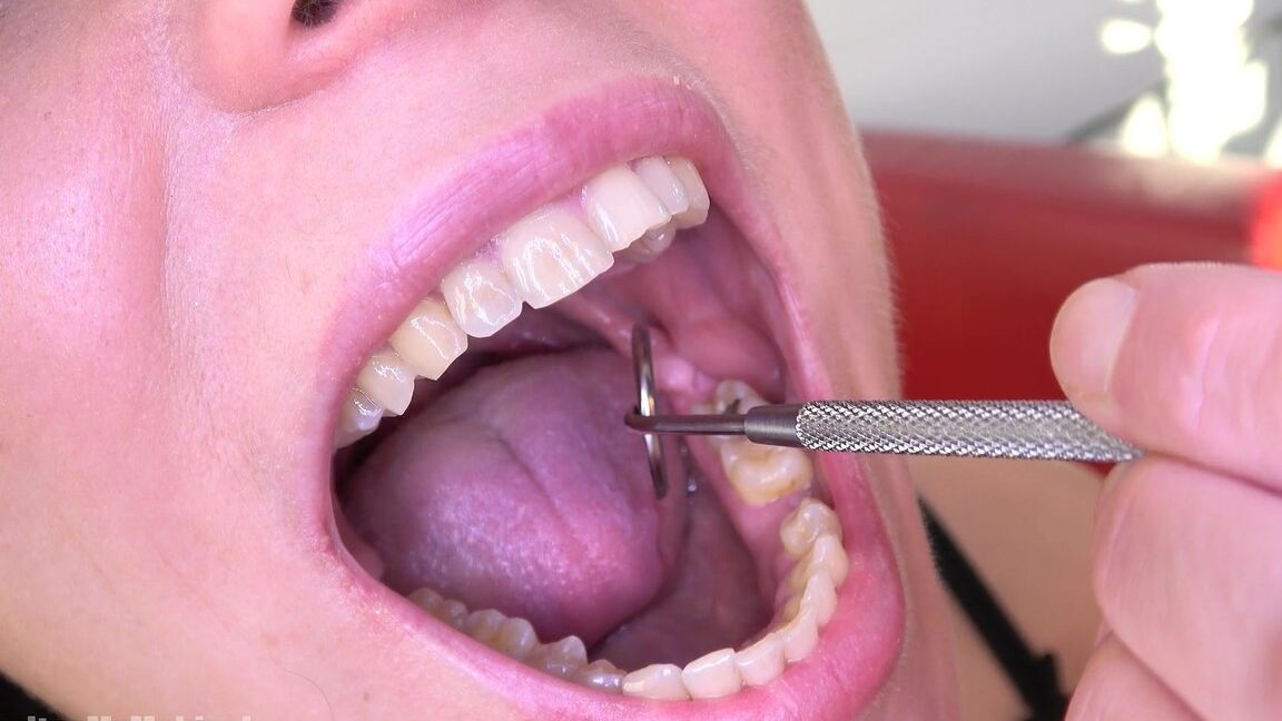 15P Inside My Mouth