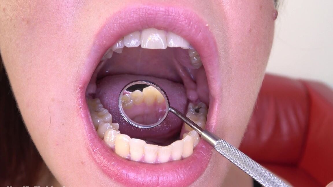 15P Inside My Mouth