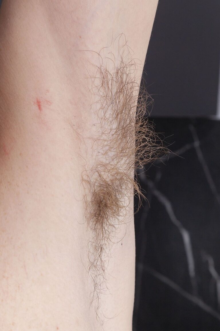 21P We Are Hairy Nimfa Mannay,