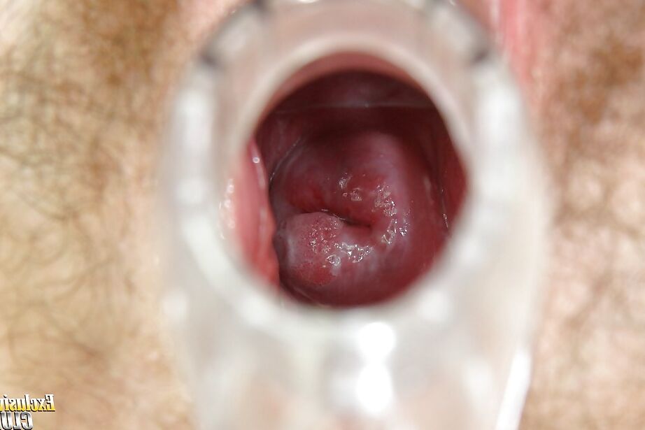 16P El coño peludo de una hermosa jovencita Amanda Vamp es objeto de burlas por parte de su médico