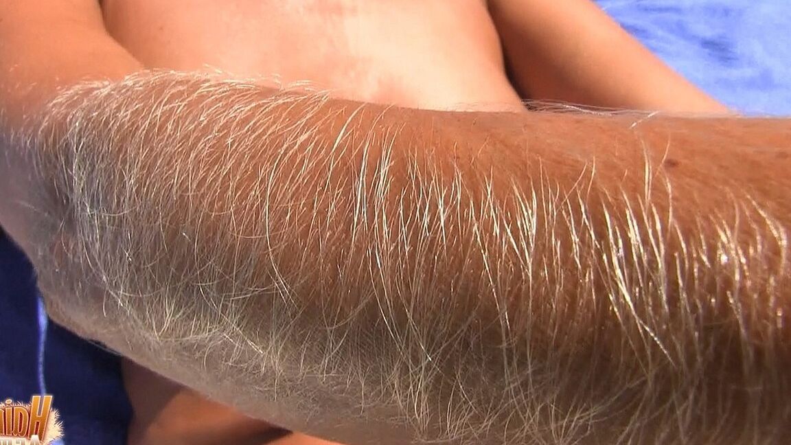 21P MILF Lori Anderson showing her hairy arms while relaxing nude at the beach