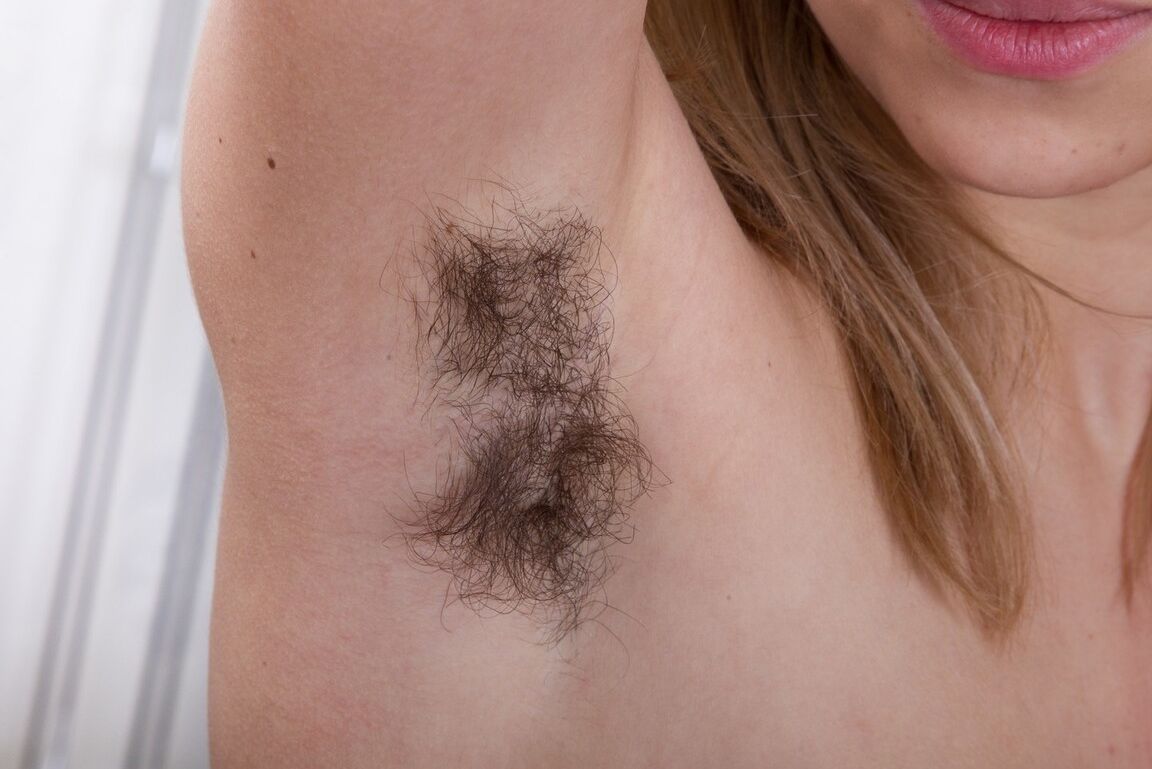 16P Pretty young Alisia flaunting hairy armpits and spreading very furry beaver