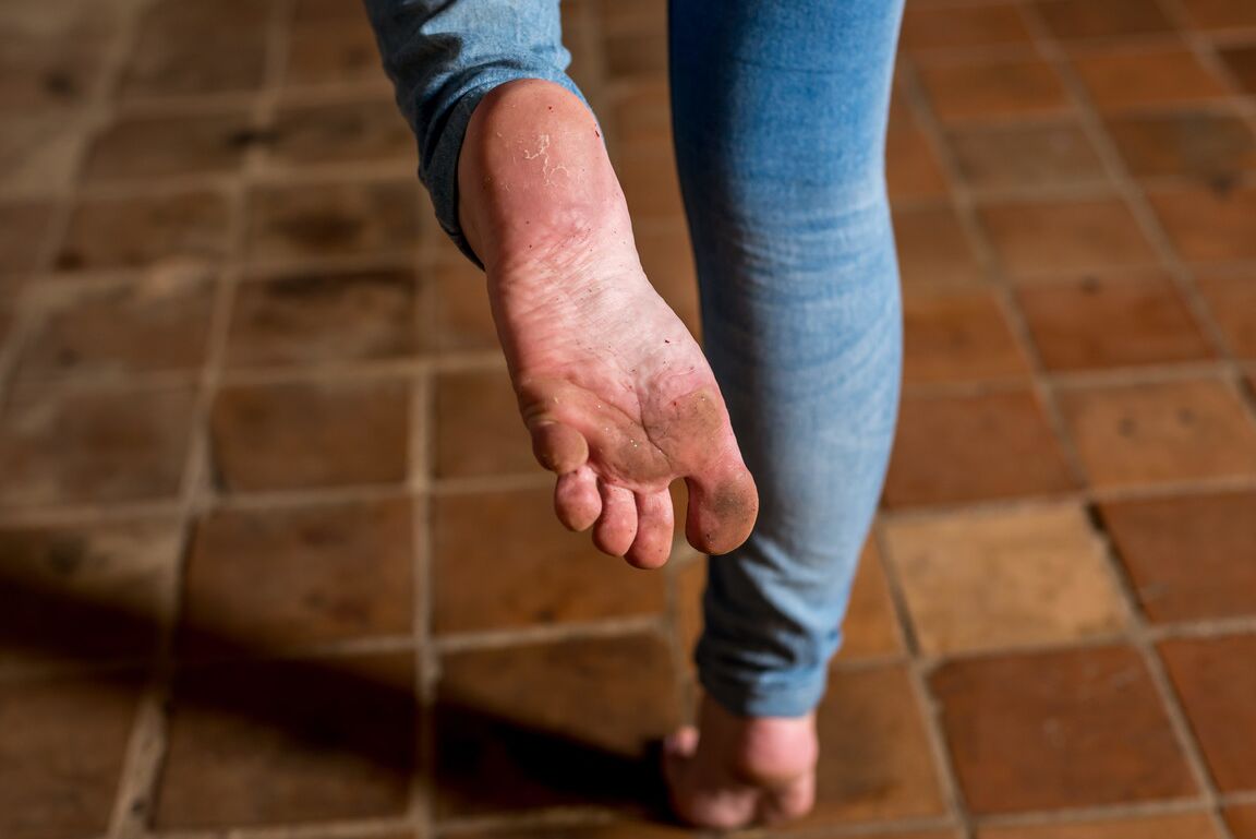 12P Kate algemada na ponta dos pés, Descalço, Bondage, Fetiche por pés