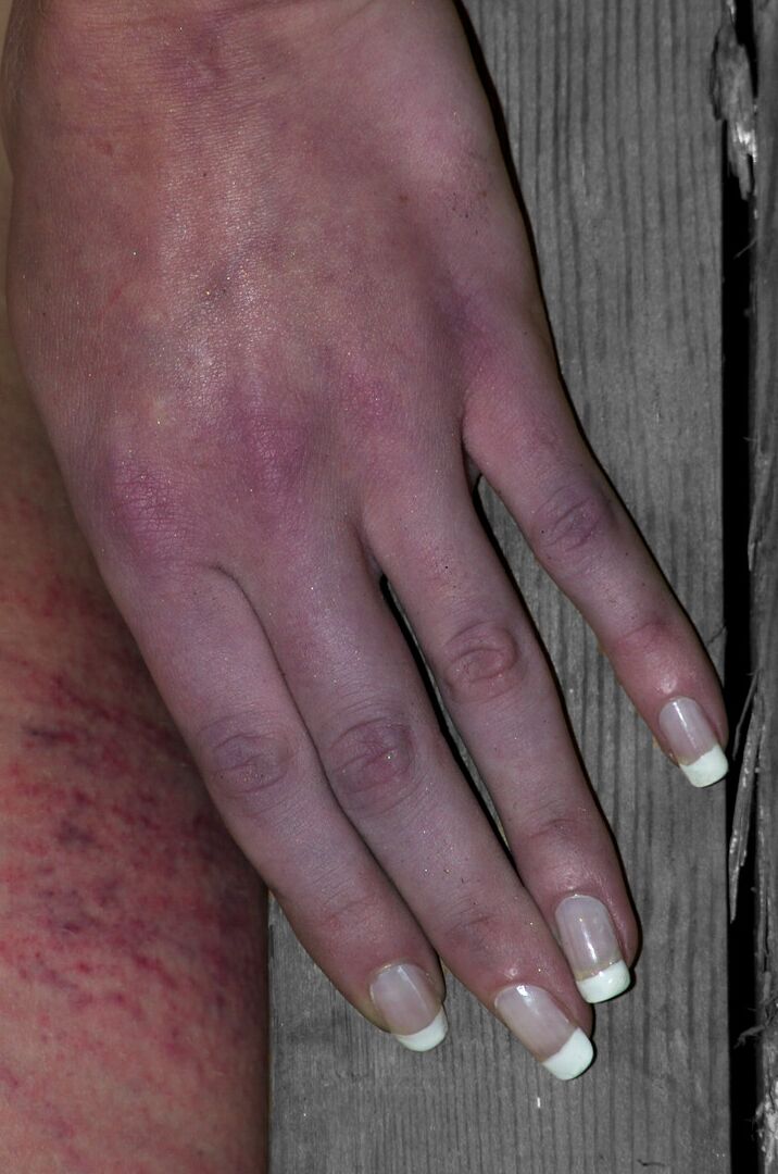 17P Tightly bound female sub turns red with pain & blue from lack of circulation
