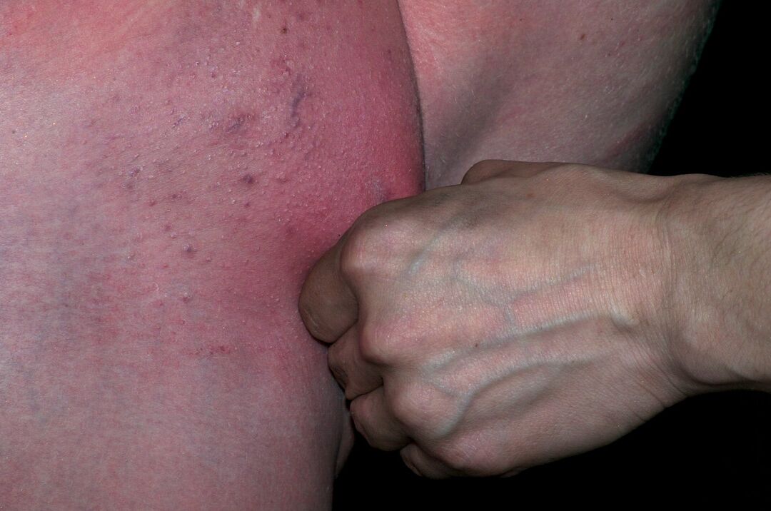 17P Tightly bound female sub turns red with pain & blue from lack of circulation