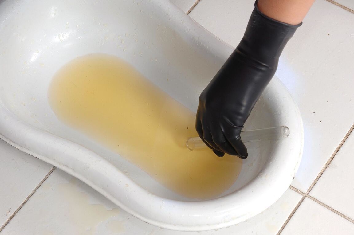 21P Latex-clad nurse Peaches helps naked Yasmine Gold do a urine test
