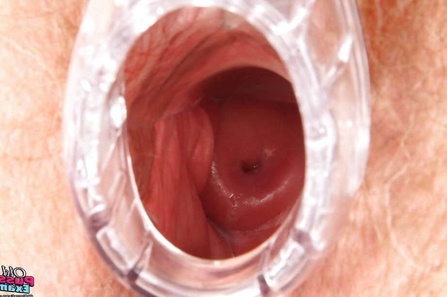 16P ストッキングを履いた好色な熟女が膣鏡を詰め込む