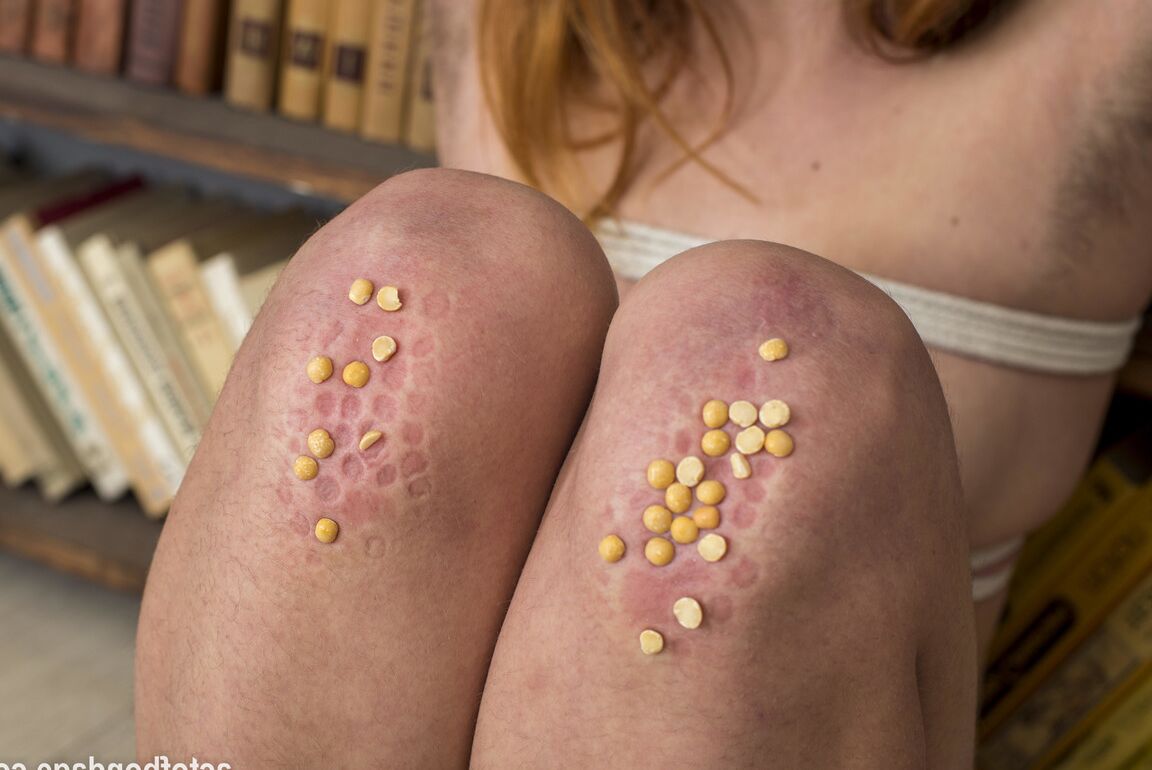 16P Natural redhead is forced to kneels on peas with hairy body exposed