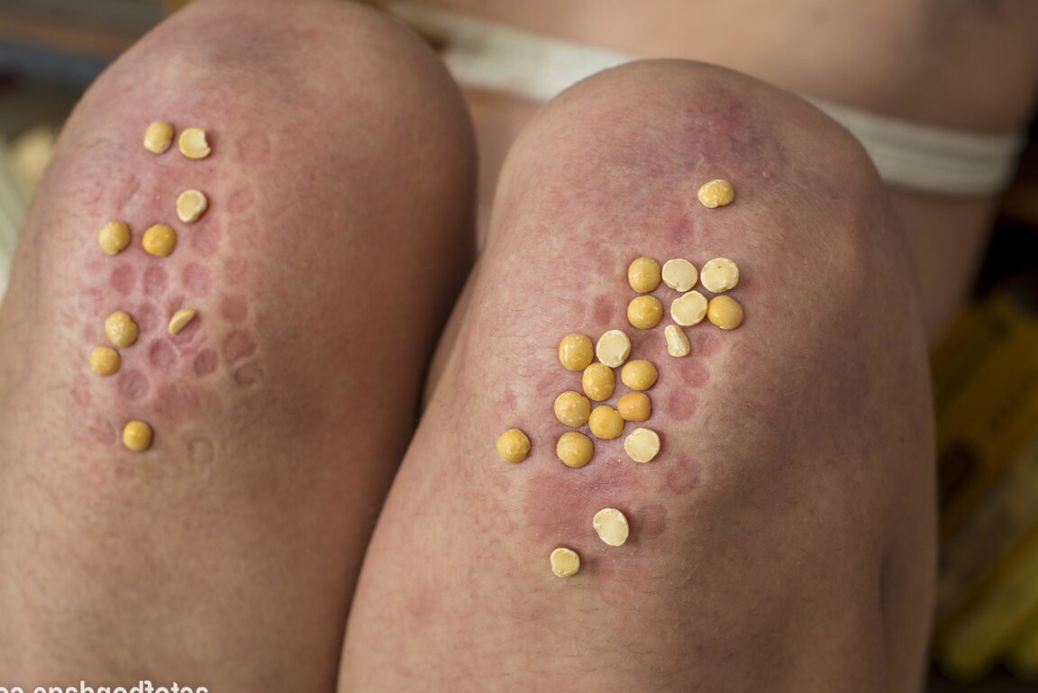 16P Natural redhead is forced to kneels on peas with hairy body exposed