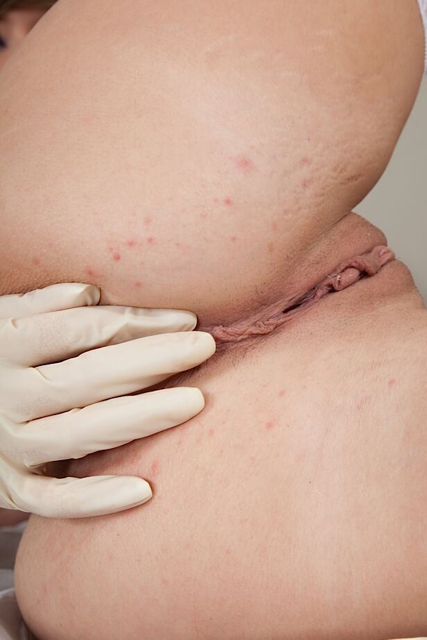 16P Infirmière tentante en bas se déshabillant et taquinant sa chatte rasée