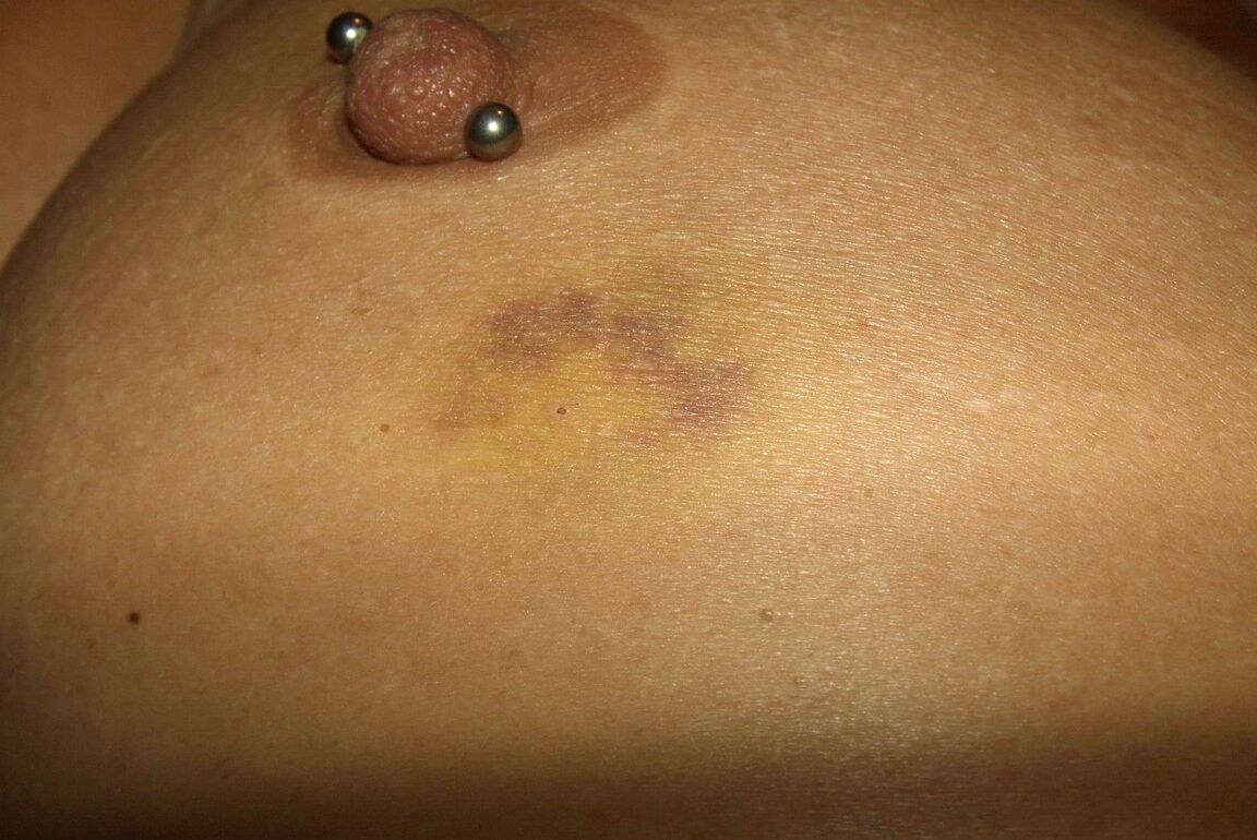 12P Close up action of a female having her breasts tortured with needles