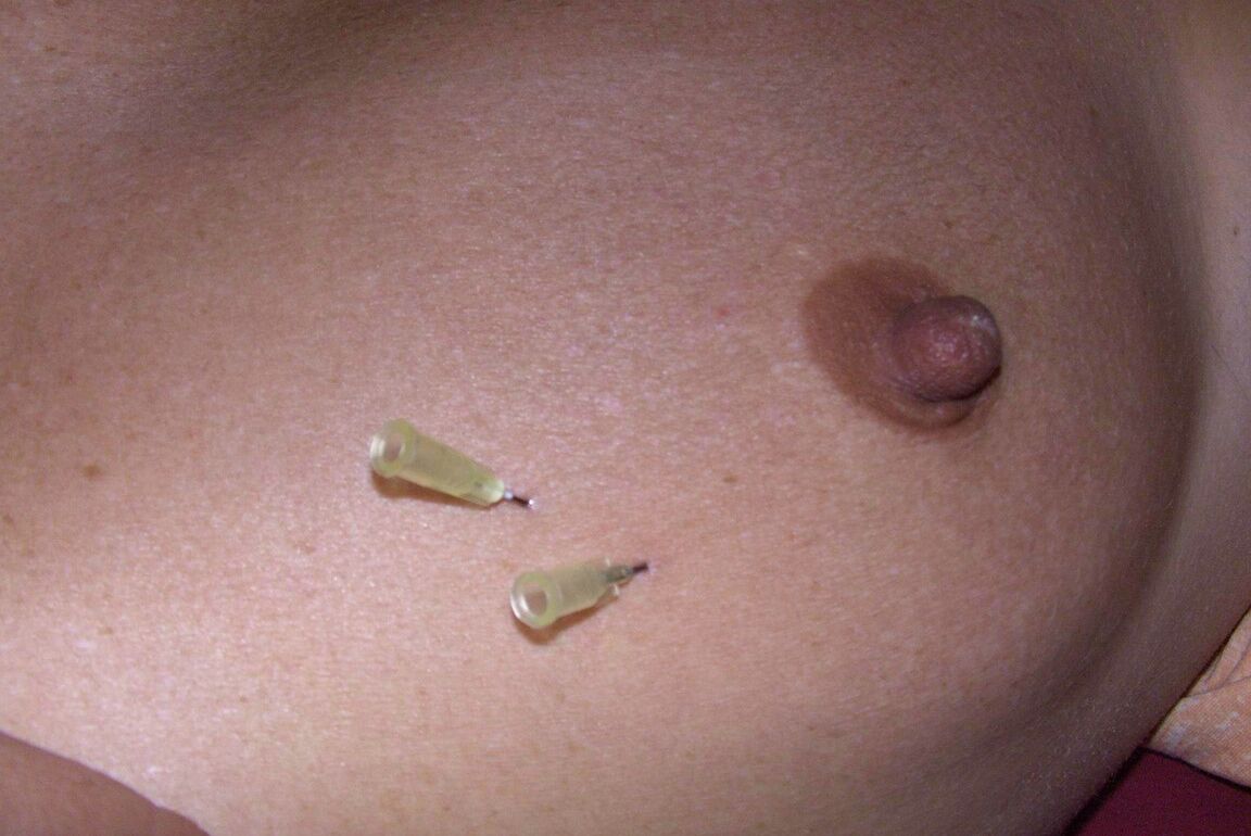 12P Close up action of a female having her breasts tortured with needles