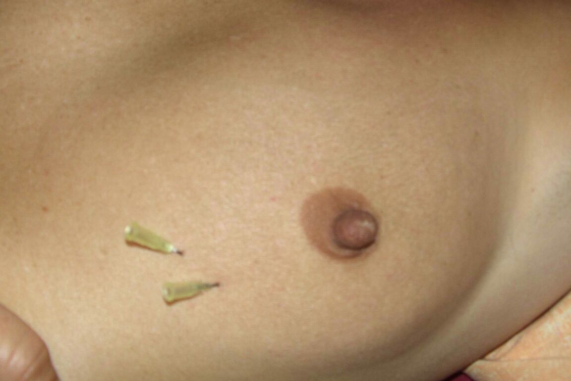 12P Close up action of a female having her breasts tortured with needles