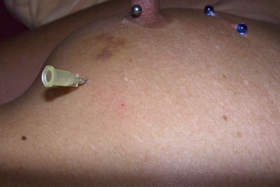 12P Close up action of a female having her breasts tortured with needles