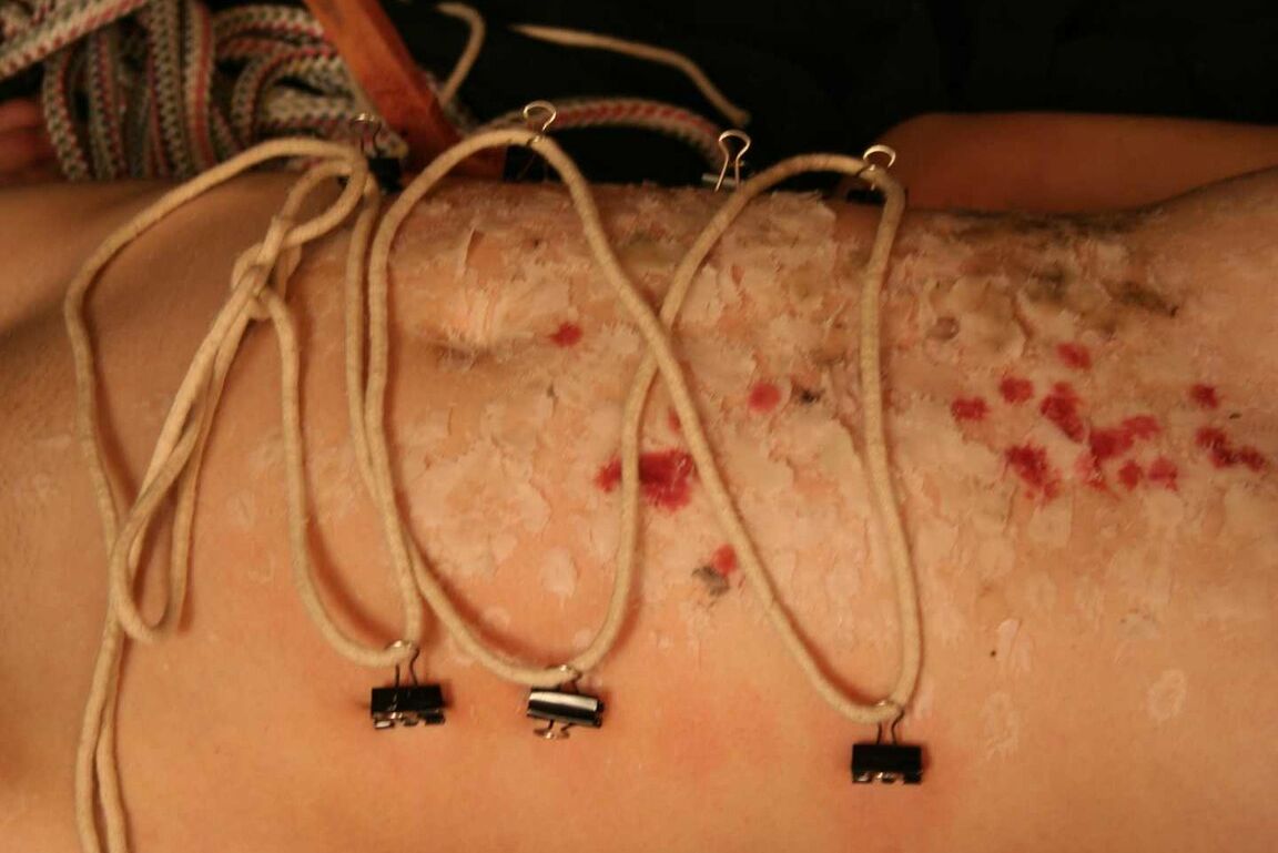 16P Redhead female is spanked after being covered in candle wax