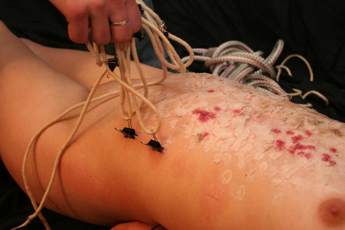 16P Redhead female is spanked after being covered in candle wax