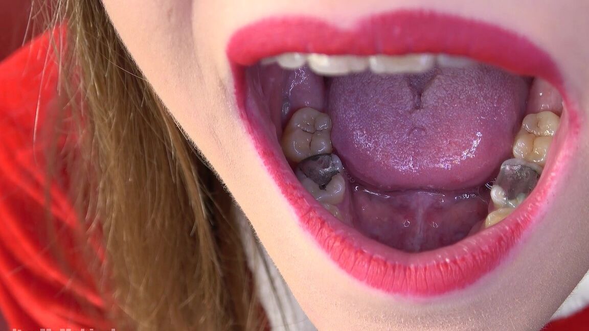16P クリスマス衣装を着た湯たんぽが口を開く