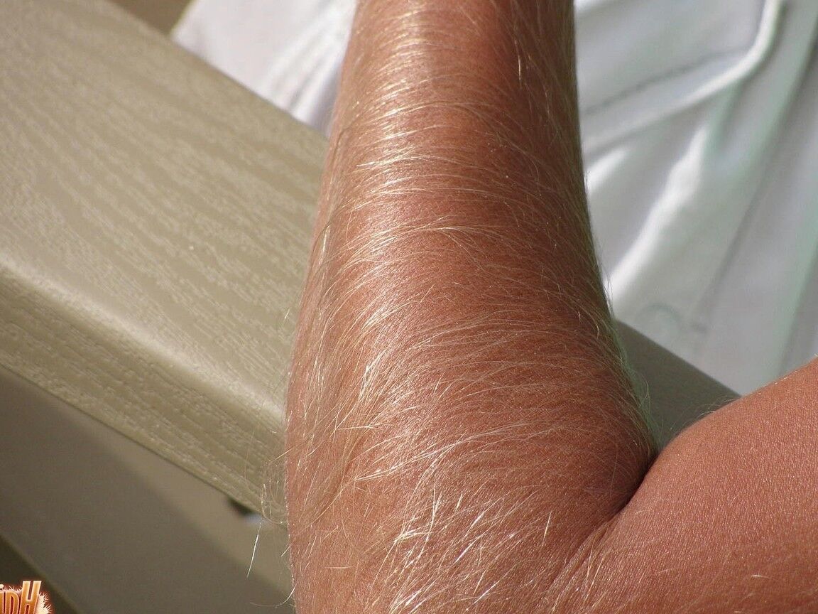 21P Skinny MILF Lori Anderson showing her hairy arms while relaxing on the beach