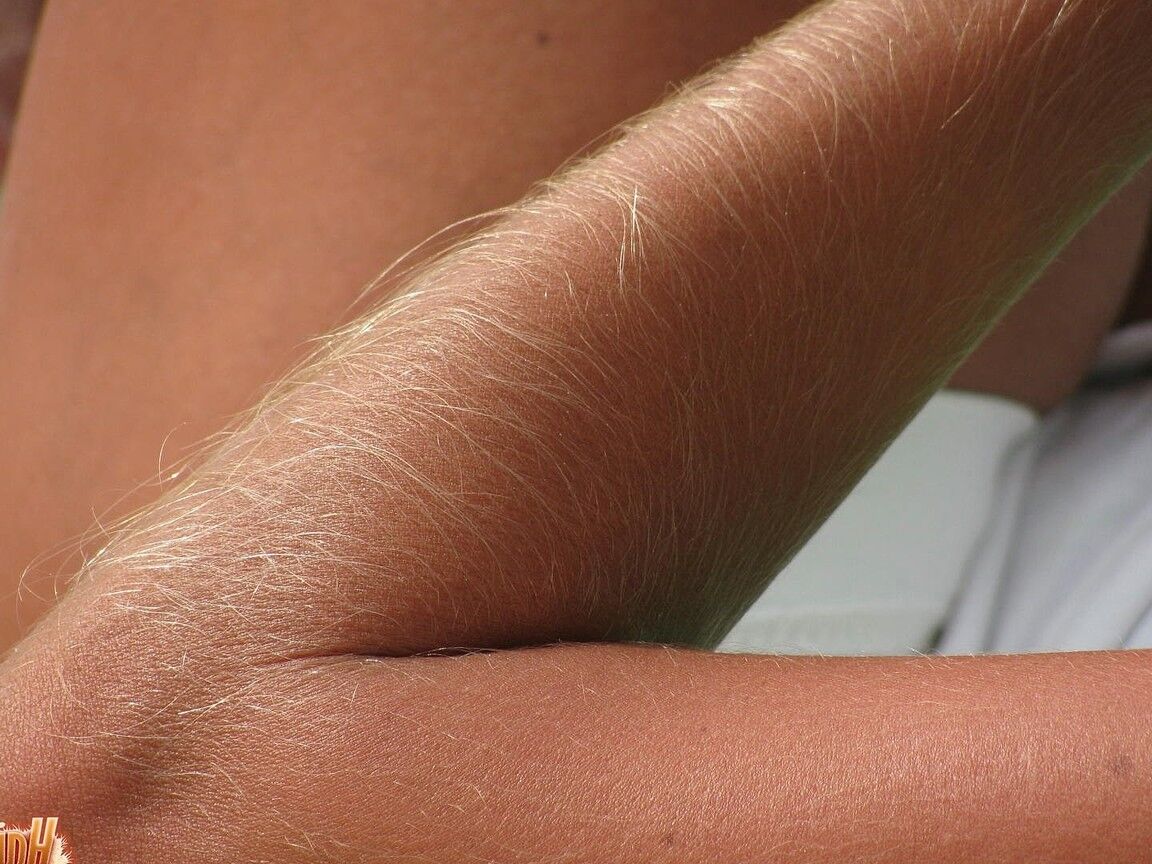 21P Skinny MILF Lori Anderson showing her hairy arms while relaxing on the beach