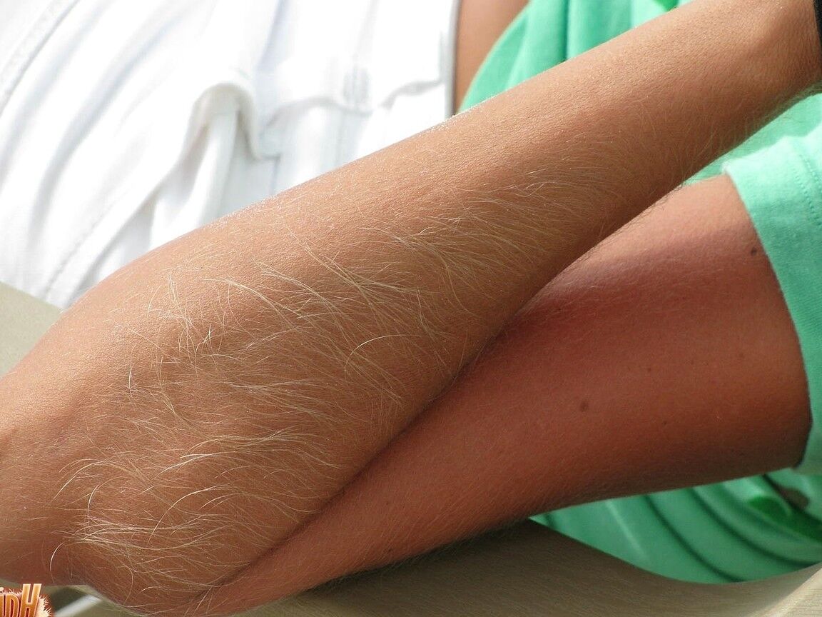 21P Skinny MILF Lori Anderson showing her hairy arms while relaxing on the beach
