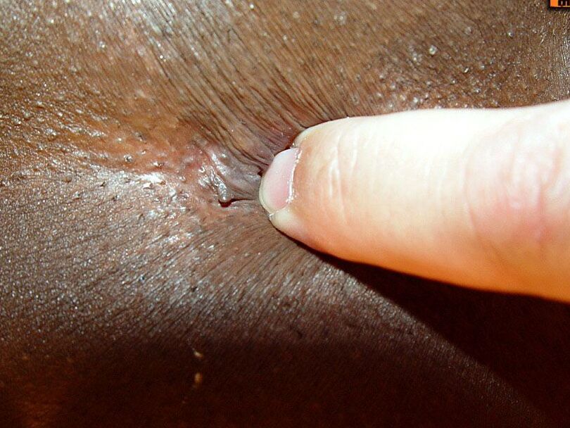 16P Negro TGirls Brisa