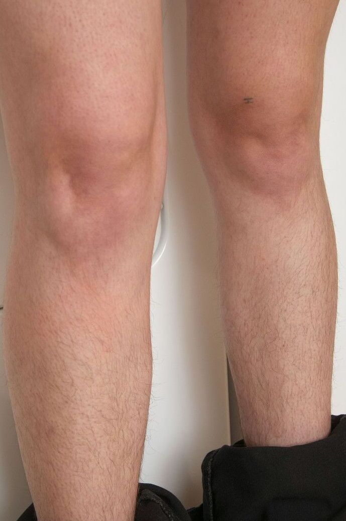 17P Modelo amadora com cabelos tingidos expõe lentamente todas as partes peludas do corpo