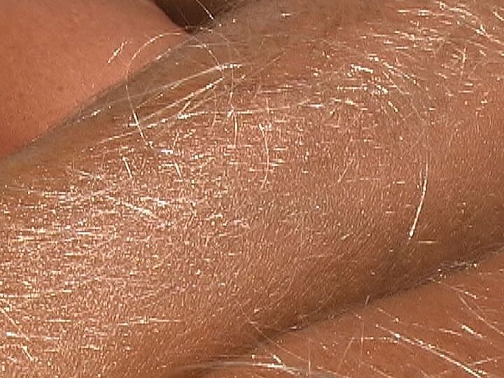 21P Beautiful tanned Lori Anderson teases with her hairy arms while sunbathing