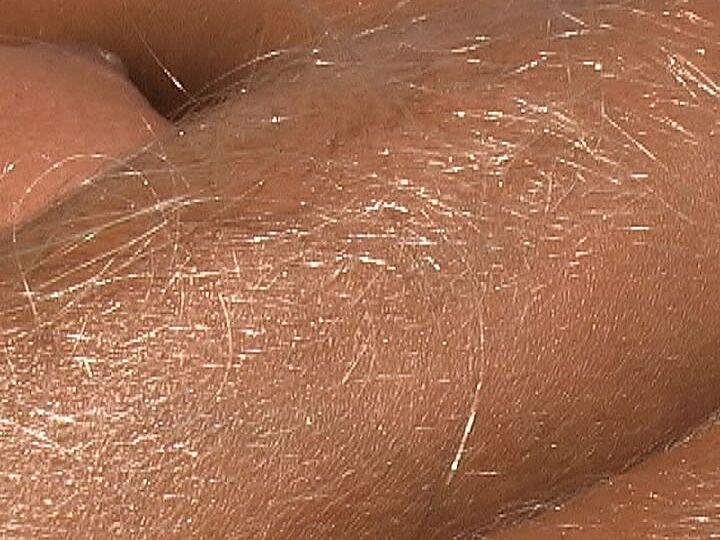 21P Beautiful tanned Lori Anderson teases with her hairy arms while sunbathing
