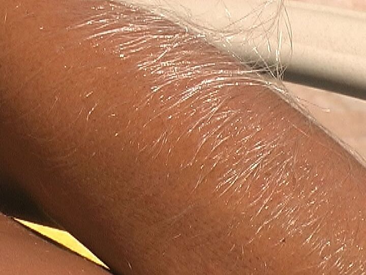 21P Beautiful tanned Lori Anderson teases with her hairy arms while sunbathing